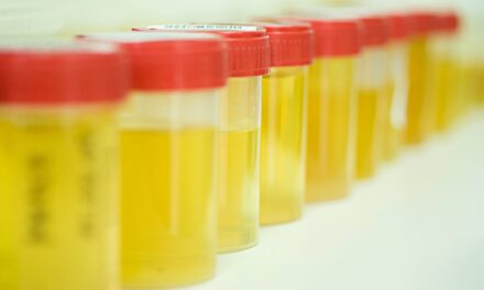Labcorp to Pay $14.5 Million to Settle Allegations of Unnecessary Urine Drug Testing