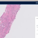 FDA Clears Proscia Digital Pathology Platform for New Scanner Compatibility