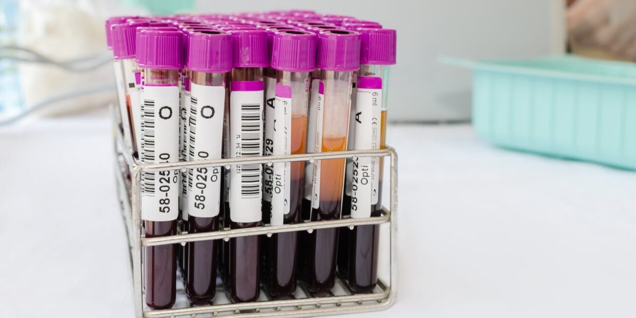 Study Validates Proteomic Blood Test for Early-Stage Breast Cancer Detection