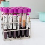 Study Validates Proteomic Blood Test for Early-Stage Breast Cancer Detection