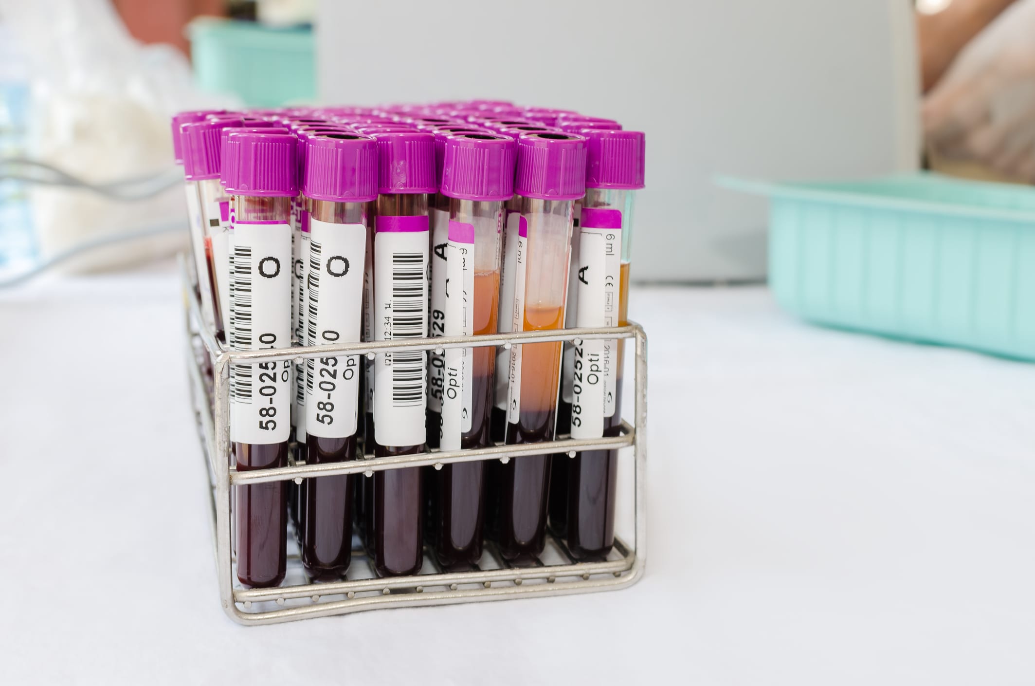 Proteomic Blood Test Validated for Early Breast Cancer Detection