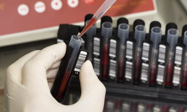 Analysis Shows Blood RNA Test Improves Breast Cancer Screening Outcomes and Cost-Effectiveness