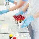 New Hemophilia Treatments Drive Need for Chromogenic Factor VIII Testing