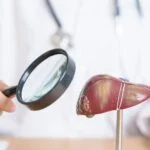 Labcorp Launches Hepatitis D Reflex Testing for Earlier Detection