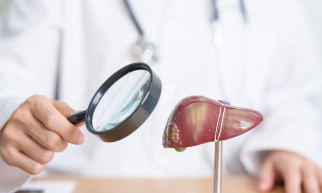 Labcorp Launches Hepatitis D Reflex Testing for Earlier Detection