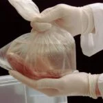National Kidney Registry to Support New Seven-Day Testing Requirements