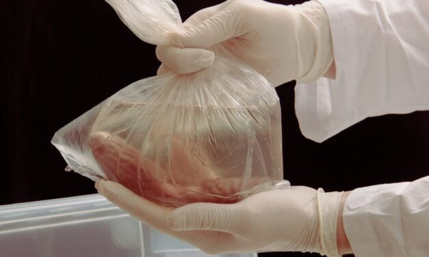 National Kidney Registry to Support New Seven-Day Testing Requirements
