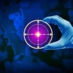 What 148 Pathologists Say About the Future of Cancer Diagnostics