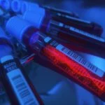 2,000-Patient Lung Cancer Project Turns to Liquid Biopsy for Genomic Screening