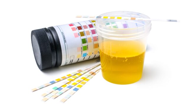 Urine Biomarker Test Improves Prediction of Donor Kidney Outcomes