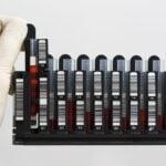 QIAGEN Launches QIAsymphony Connect for Automated Nucleic Acid Extraction