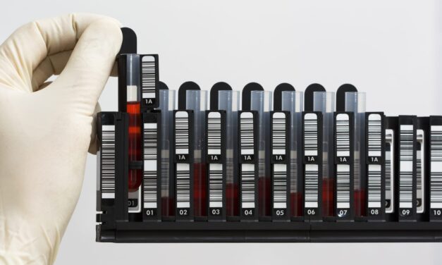 QIAGEN Launches QIAsymphony Connect for Automated Nucleic Acid Extraction