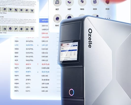 Ozelle Launches AI-Powered Hematology Analyzer with Image-Based Morphology