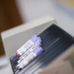 FDA Clears Alzheimer’s Blood Test for Adults as Young as 40