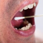 NIH Grant Supports Development of Rapid Chairside Oral Cancer Test