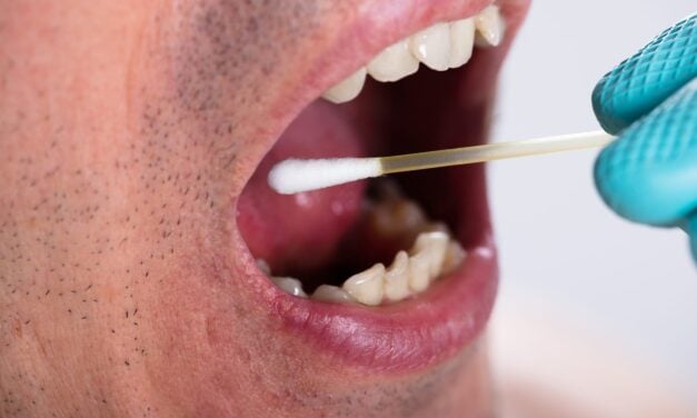 NIH Grant Supports Development of Rapid Chairside Oral Cancer Test