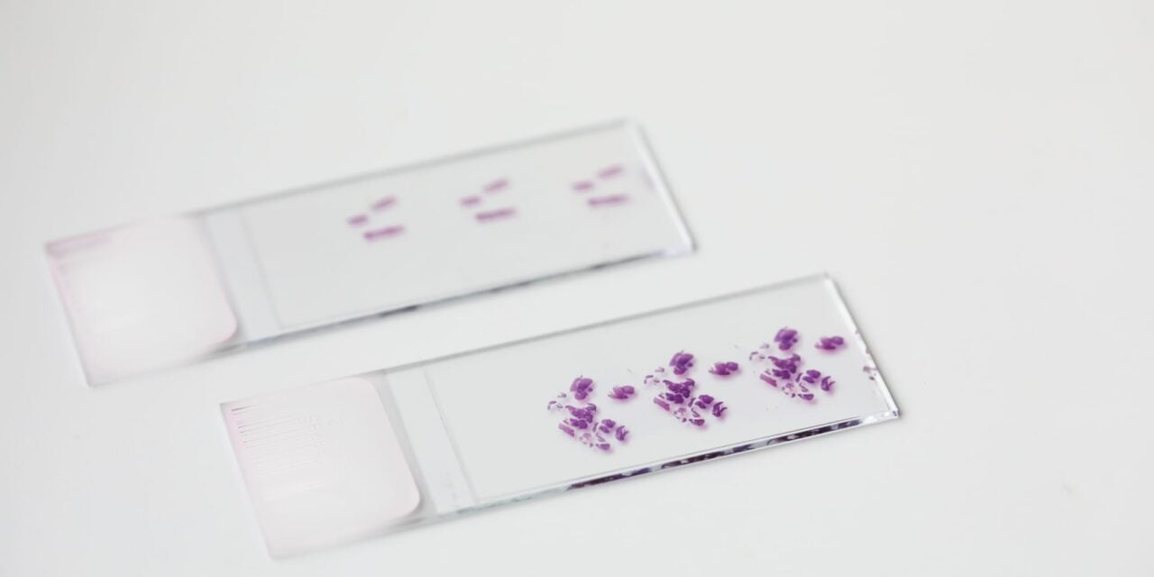 10x Genomics and Lausanne University Hospital Collaborate on Cancer Diagnostic Research