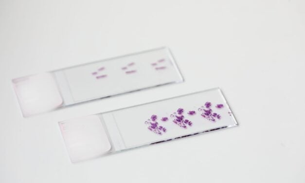 10x Genomics and Lausanne University Hospital Collaborate on Cancer Diagnostic Research