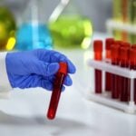 Routine Blood Test Trends Improve Cancer Risk Prediction in Patients With Unexplained Weight Loss