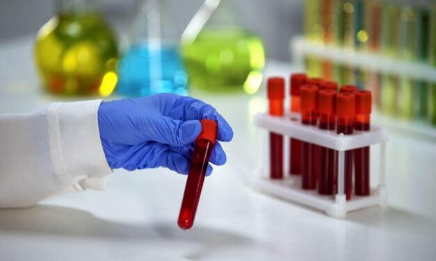 Routine Blood Test Trends Improve Cancer Risk Prediction in Patients With Unexplained Weight Loss