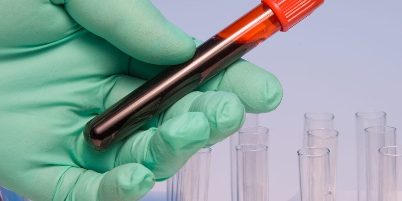 Siemens Healthineers and Novo Partner to Expand Blood-Based Testing for MASLD and MASH