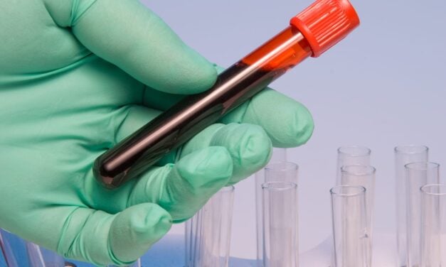 Siemens Healthineers and Novo Partner to Expand Blood-Based Testing for MASLD and MASH