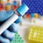 Siemens Healthineers Launches FDA-Cleared D-Dimer Blood Test