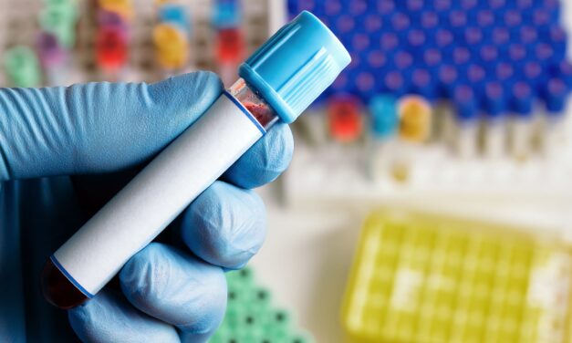Siemens Healthineers Launches FDA-Cleared D-Dimer Blood Test