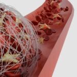 Understanding Fibrinogen Testing in the Clinical Laboratory