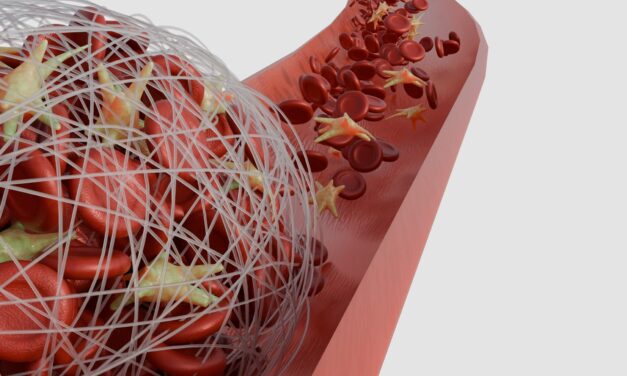 Understanding Fibrinogen Testing in the Clinical Laboratory