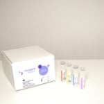 Yourgene Health Launches IVDR-Certified DPYD Chemotherapy Toxicity Assay