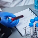 5Q Spectra to Debut Blood Test for Prostate Cancer Detection
