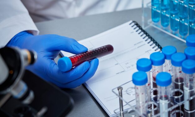5Q Spectra to Debut Blood Test for Prostate Cancer Detection