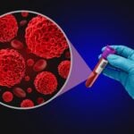 BillionToOne Launches Liquid Biopsy Test to Identify Cancer Tissue of Origin
