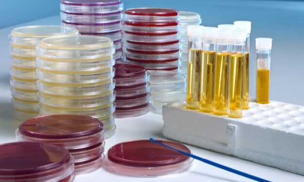 SHEA Framework Shows Diagnostic Stewardship Can Save Hospitals Up to $2.8M Annually