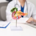 AI Spatial Analysis of Standard Pathology Slides Predicts Pancreatic Cancer Recurrence Risk