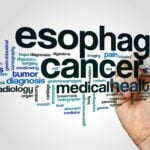 Lucid Diagnostics Secures Favorable Medicare, CPT, and ICD-10 Recommendations for Esophageal Cancer Tests