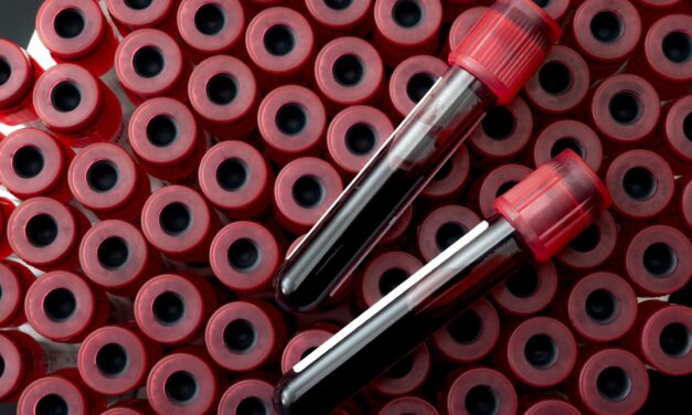 FDA Advisory Panel Backs Approval of GRAIL’s Galleri Multi-Cancer Early Detection Test