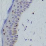 DNA Test Diagnoses Inherited Muscle Diseases Missed by Standard Testing