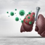 FDA Clears Multiplex PCR Panel for 13 Respiratory Pathogens