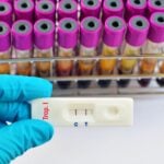 Rapid Cardiac Troponin Testing Does Not Reduce Emergency Department Length of Stay