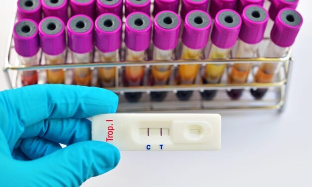 Rapid Cardiac Troponin Testing Does Not Reduce Emergency Department Length of Stay