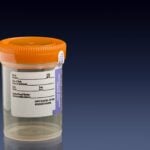 FDA Grants Breakthrough Device Designation to Same-Day Urine ID/AST Test