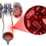Rapid PCR Test for UTIs Enters Clinical Use in UK