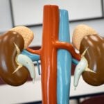 Broader Screening Criteria Double Positive Results for Primary Aldosteronism, Study Finds