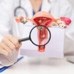 Study Finds Molecular HPV Testing Identifies Cervical Abnormalities Missed by Pap Smears