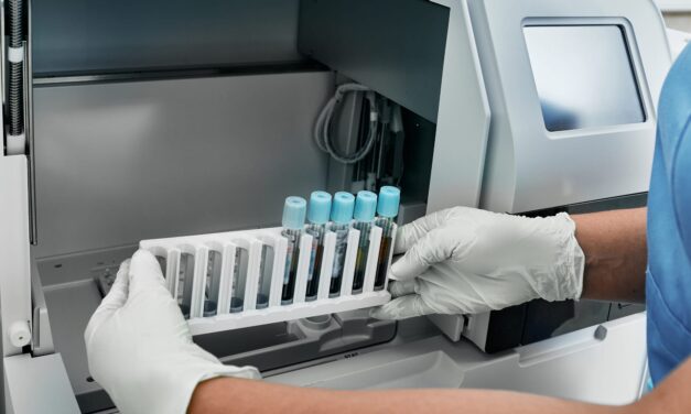 Understanding the Activated Partial Thromboplastin Time in the Modern Coagulation Lab