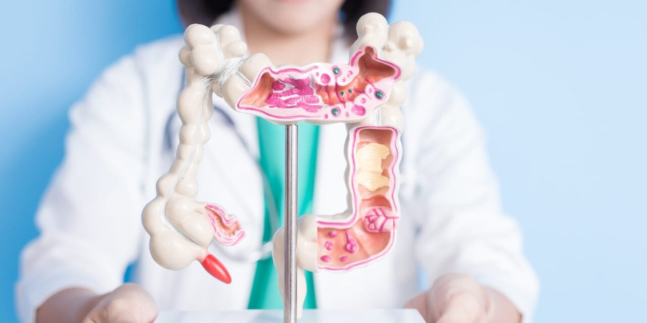 Haystack MRD Accurately Predicts Colorectal Cancer Recurrence, Study Finds