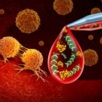 Biodesix Advances Tumor-Informed and Tumor-Naïve MRD Assays