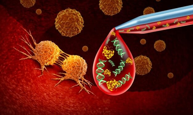 Biodesix Advances Tumor-Informed and Tumor-Naïve MRD Assays